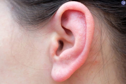 انواع پروتز گوش | پروتز گوش چیست | پروتز گوش میانی چیست