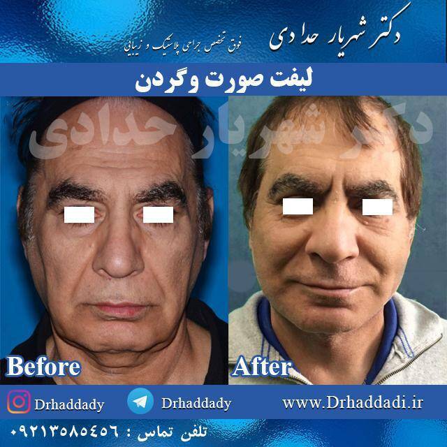 جراحی جراحی