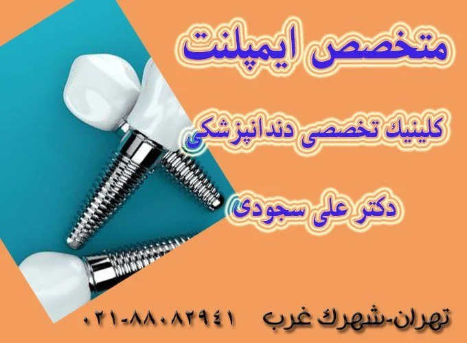 ایمپلنت