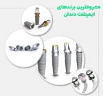 ایمپلنت | دندان | کاشت