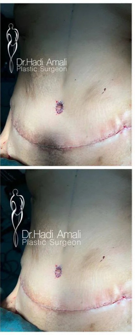 جراحی | جراحی زیبایی