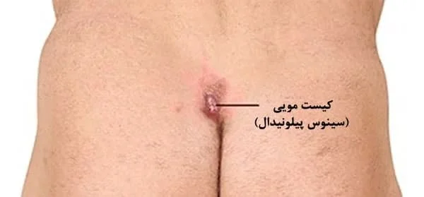 رسانه عمومی