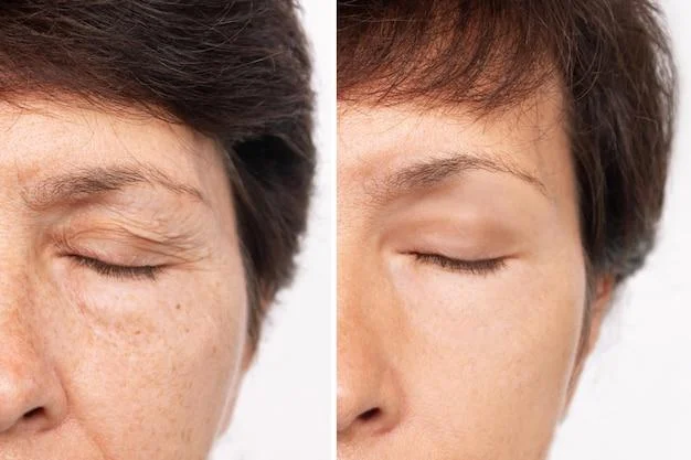 The best eye cream for over 40 years