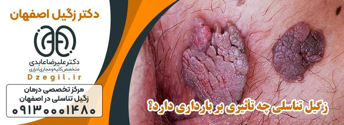 زگیل تناسلی
