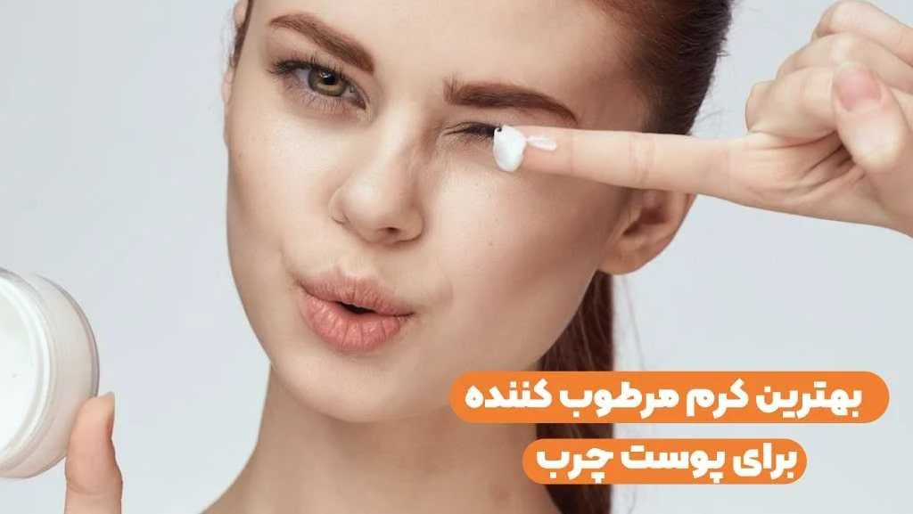 پوست چرب