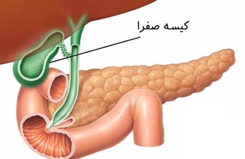 جراحی | کیس | هزینه