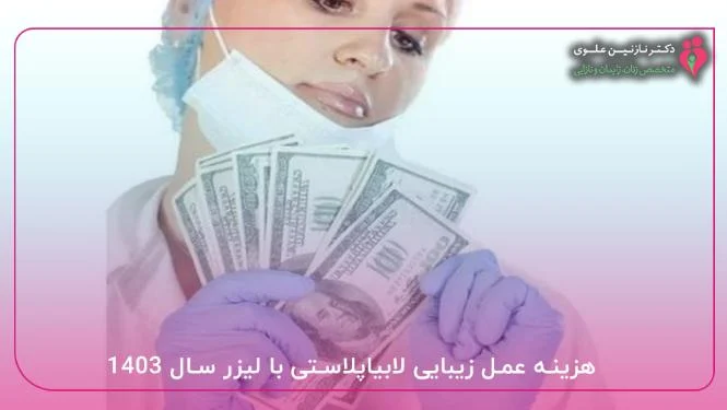اپل