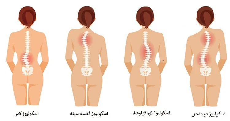 بیماری