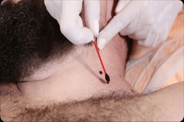 نقره نقره
